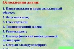 Осложнения ангины