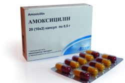 Амоксициллин при фарингите